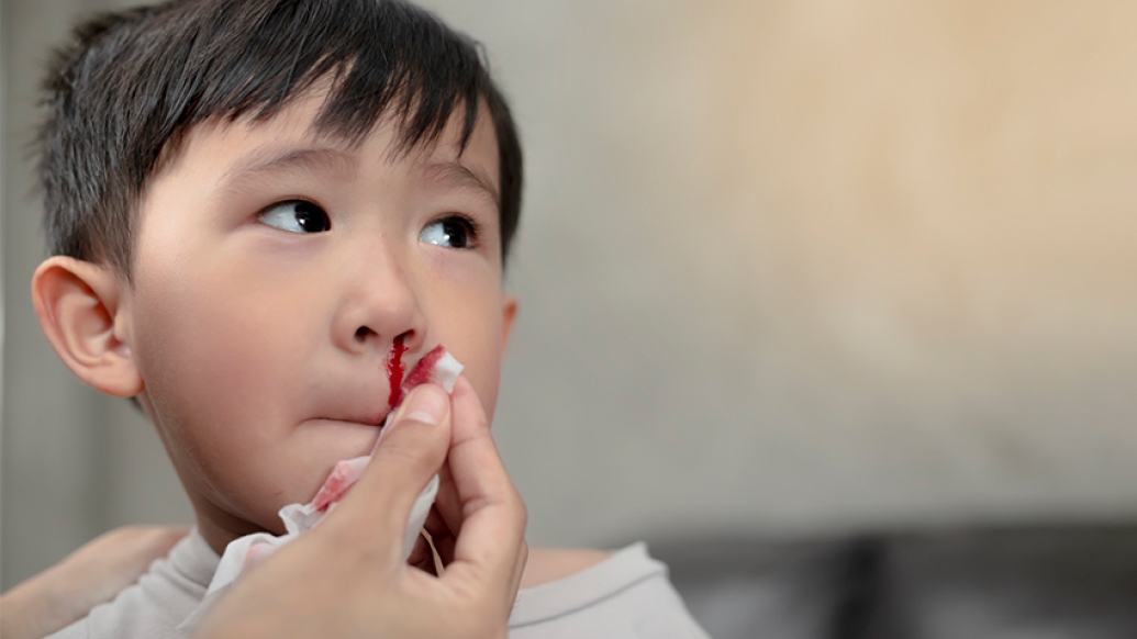 child nose bleeding blood tissue